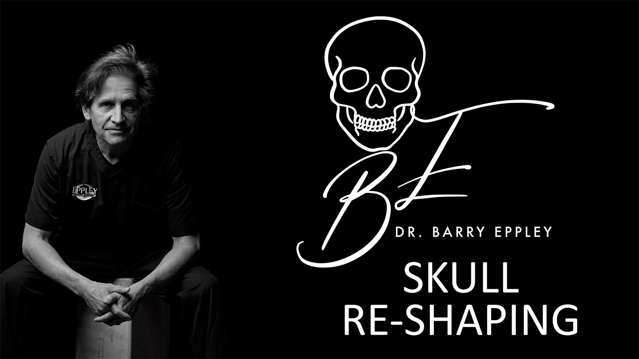 Dr. Eppley and Skull Reshaping -Creating a Rounder Contour